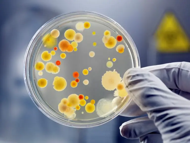 Factors affecting growth of Micro-organism in food (Intrinsic and Extrinsic)